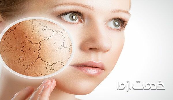 علت خشکی پوست