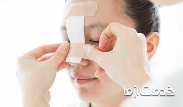 مهم ترین اقدامات در هنگام شکستگی بینی چیست؟
