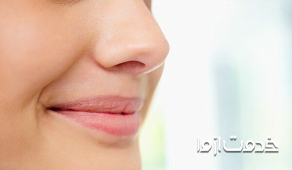 لیفت بینی