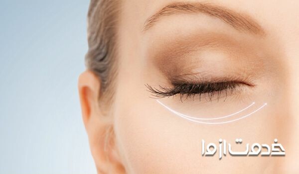 انواع کرم آبرسان دور چشم و ویژگیهای آن