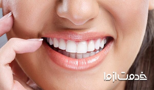 سفید کردن دندان با روشهای خانگی