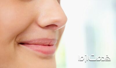 لیفت بینی