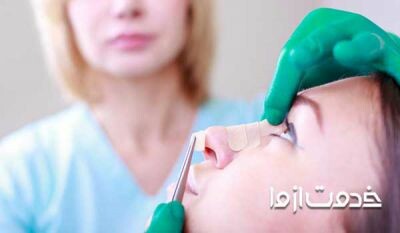 مراقبت های بعد از عمل بینی را جدی بگیرید