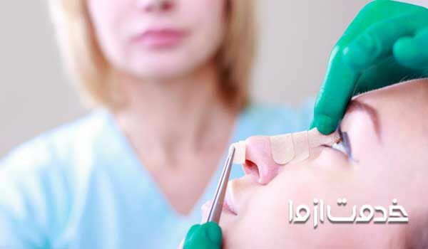 هزینه ترمیم بینی چقدر است جراحی بینی با قیمت 2 میلیون هزینه عمل بینی در مشهد هزینه جراحی بینی در قزوین